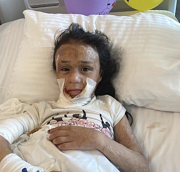 Yanan Iraklı 8 yaşındaki kıza Antalya'da estetik operasyon