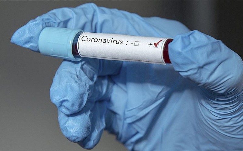 Gana'da ilk yeni tip koronavirüs vakaları görüldü