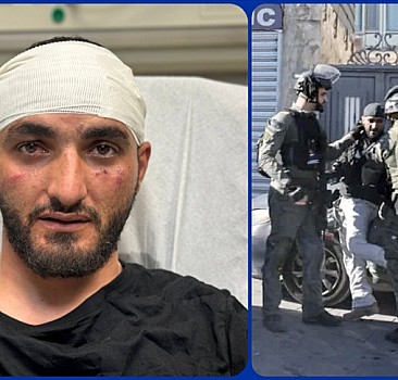 İsrail polisinden gazetecilere sert müdahale