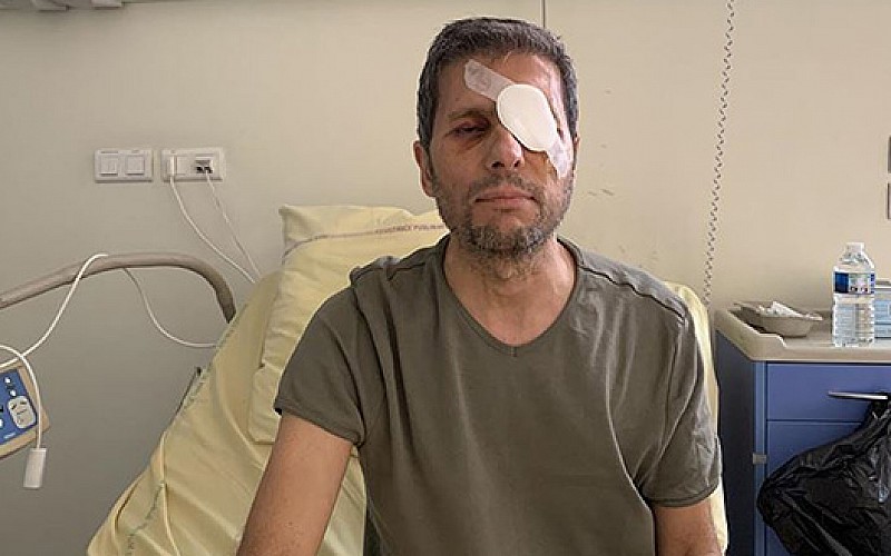Fransız polisi tarafından gözünden yaralanan AA Foto Muhabiri Yalçın yaşadıklarını anlattı
